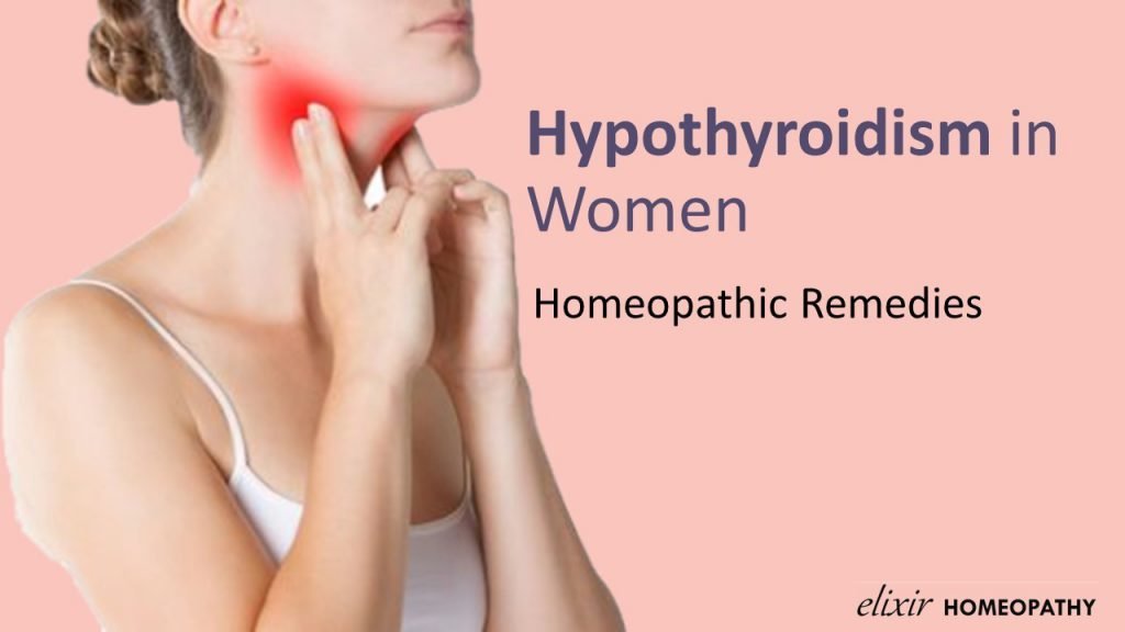 Treatment of hypothyroidism in women.